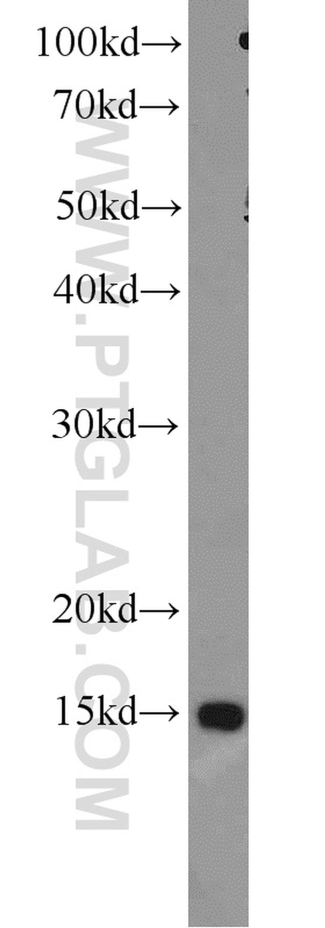 SH2D1B Antibody in Western Blot (WB)