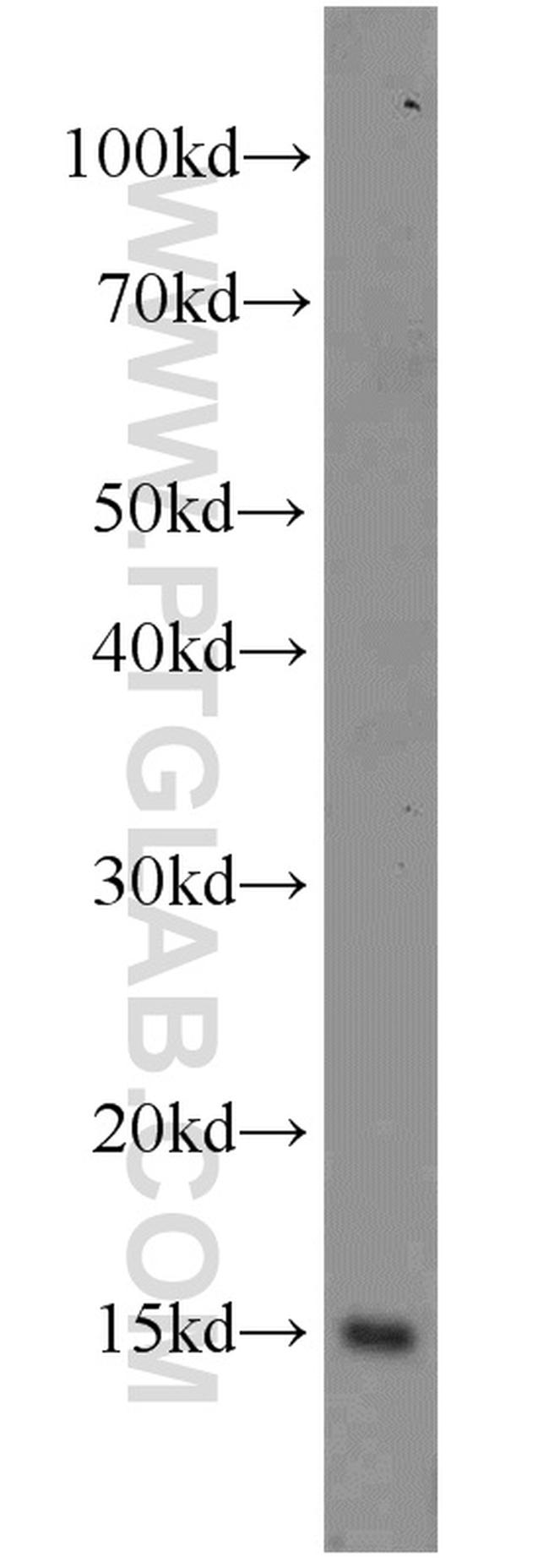 SH2D1B Antibody in Western Blot (WB)