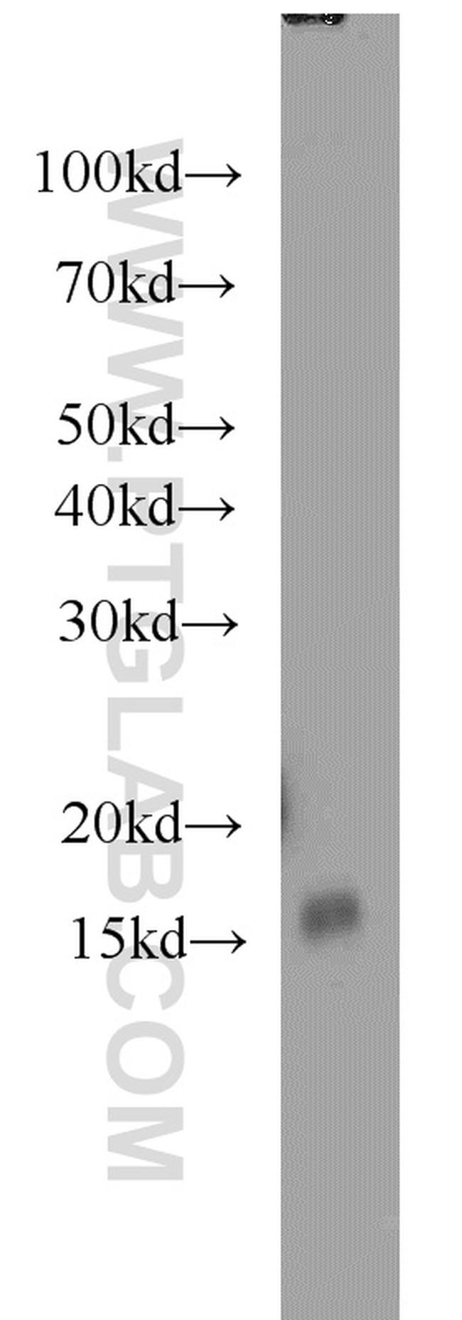 SH2D1B Antibody in Western Blot (WB)