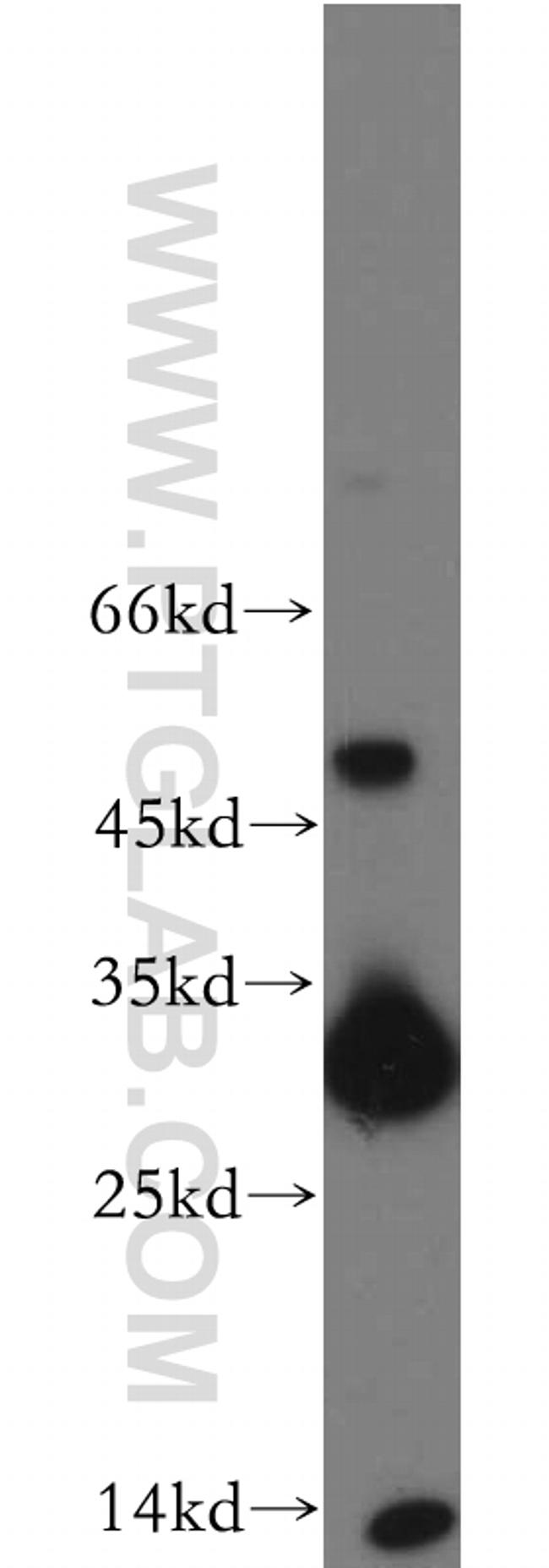 TIM3 Antibody in Western Blot (WB)