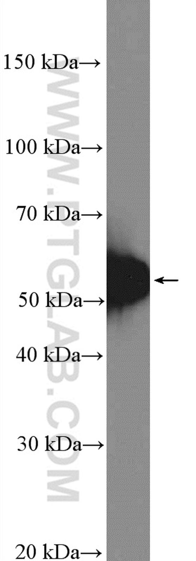 TIM3 Antibody in Western Blot (WB)