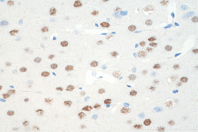 LDB2 Antibody in Immunohistochemistry (Paraffin) (IHC (P))