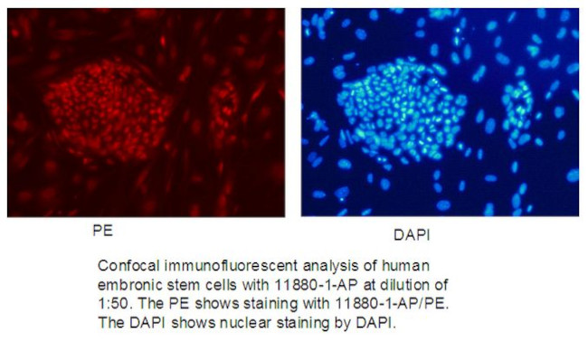 KLF4 Antibody in Immunocytochemistry (ICC/IF)