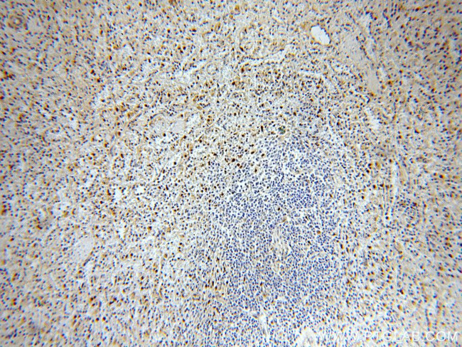 KLF4 Antibody in Immunohistochemistry (Paraffin) (IHC (P))