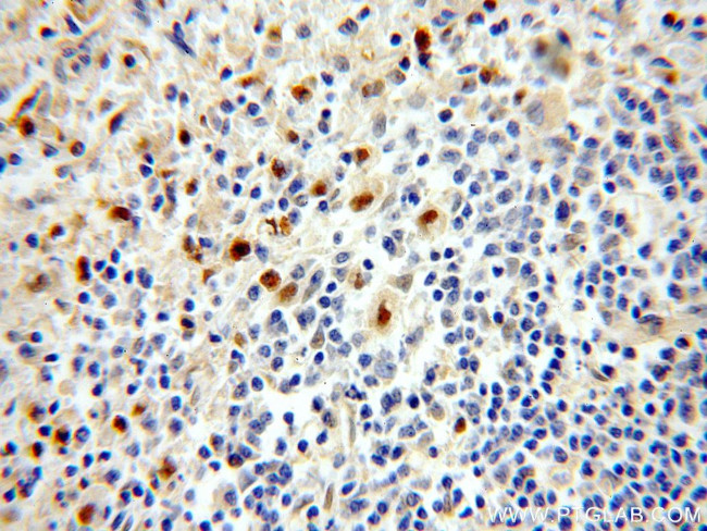 KLF4 Antibody in Immunohistochemistry (Paraffin) (IHC (P))