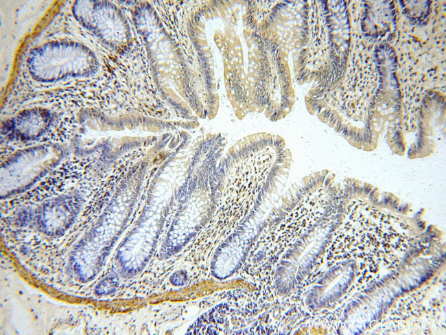 KLF4 Antibody in Immunohistochemistry (Paraffin) (IHC (P))