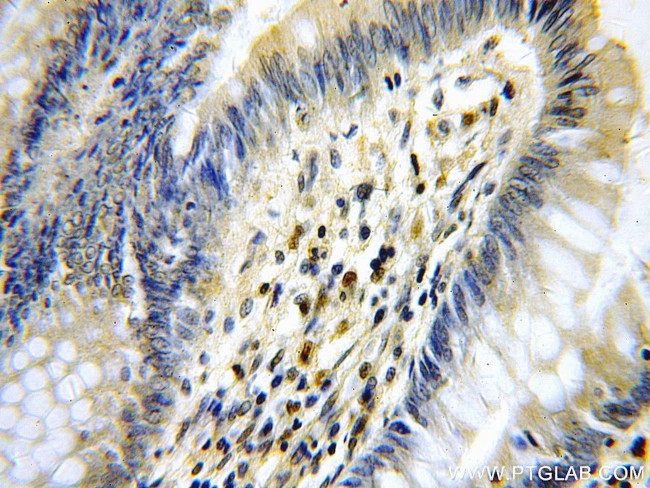 KLF4 Antibody in Immunohistochemistry (Paraffin) (IHC (P))