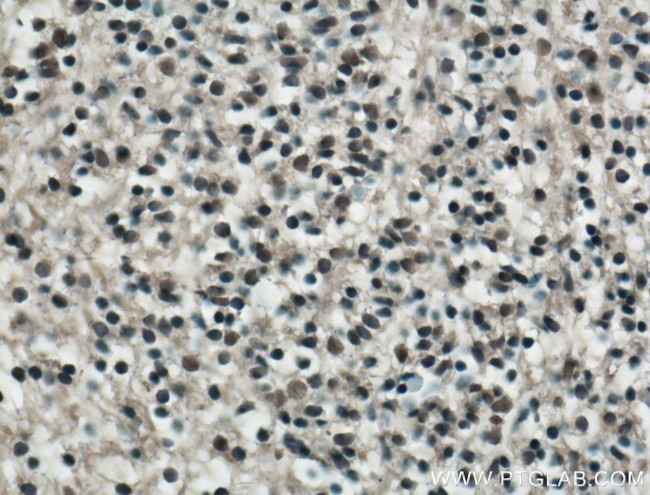 KLF4 Antibody in Immunohistochemistry (Paraffin) (IHC (P))