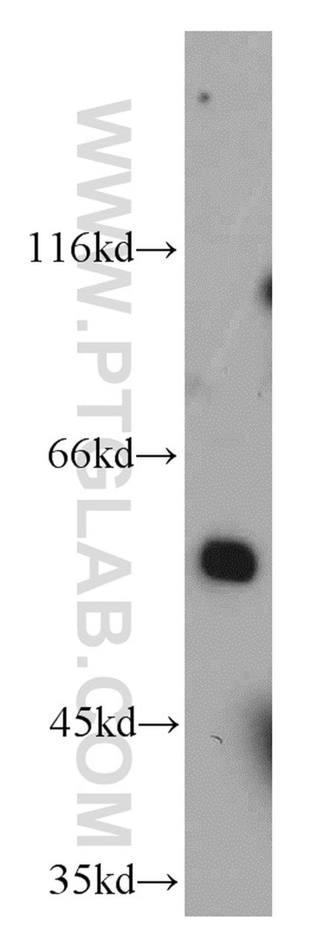 KLF4 Antibody in Western Blot (WB)