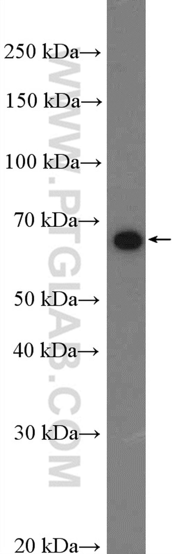 KLF4 Antibody in Western Blot (WB)