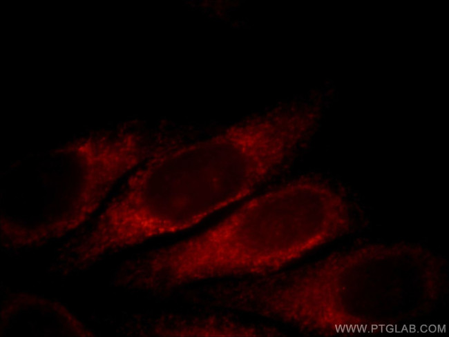 SLC4A4 Antibody in Immunocytochemistry (ICC/IF)