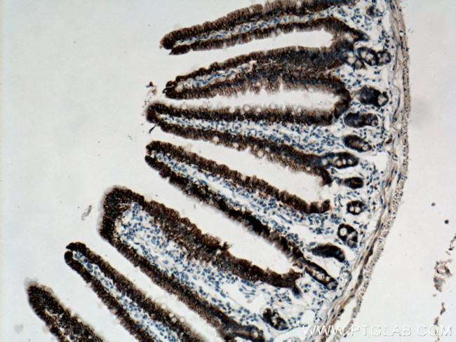 SLC4A4 Antibody in Immunohistochemistry (Paraffin) (IHC (P))