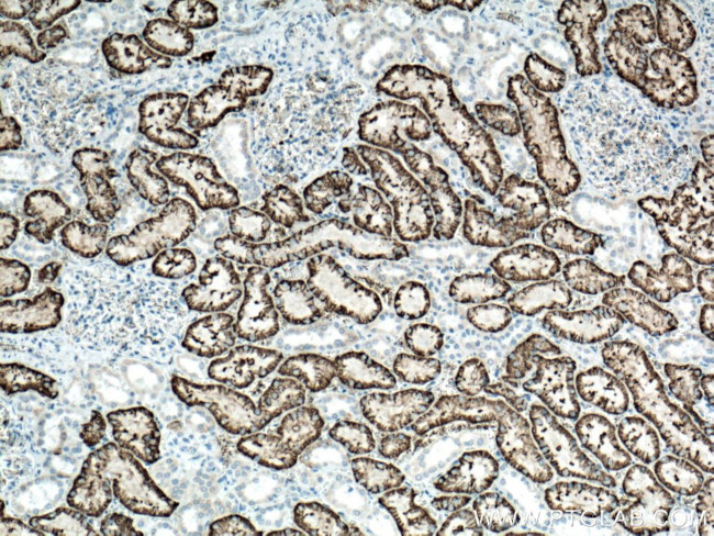 SLC4A4 Antibody in Immunohistochemistry (Paraffin) (IHC (P))