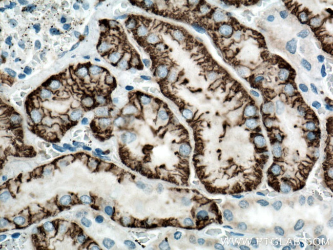 SLC4A4 Antibody in Immunohistochemistry (Paraffin) (IHC (P))