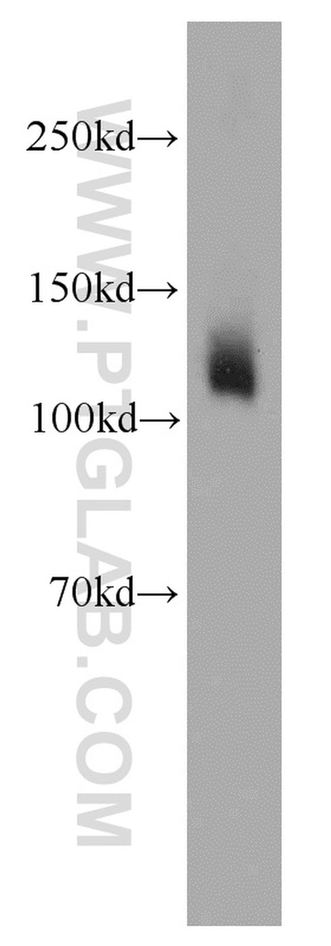 SLC4A4 Antibody in Western Blot (WB)