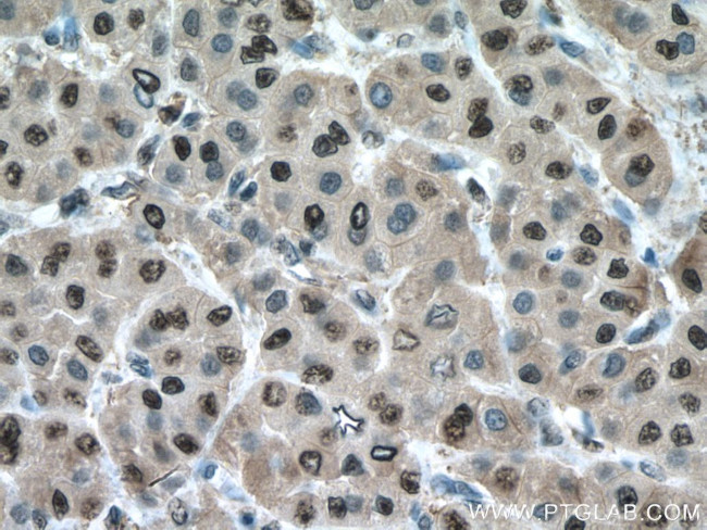 PSMA3 Antibody in Immunohistochemistry (Paraffin) (IHC (P))