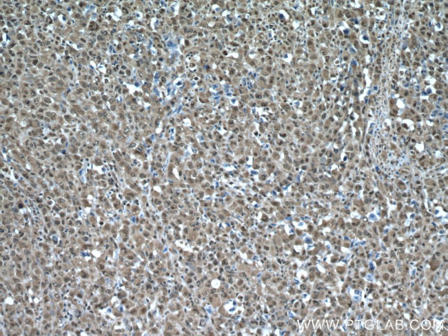 PSMA3 Antibody in Immunohistochemistry (Paraffin) (IHC (P))