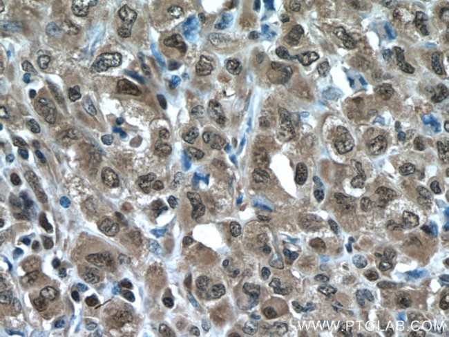 PSMA3 Antibody in Immunohistochemistry (Paraffin) (IHC (P))