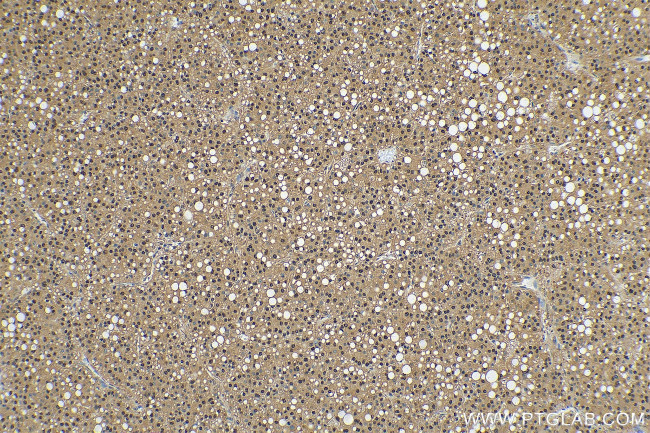 PSMA3 Antibody in Immunohistochemistry (Paraffin) (IHC (P))