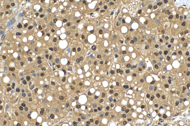 PSMA3 Antibody in Immunohistochemistry (Paraffin) (IHC (P))