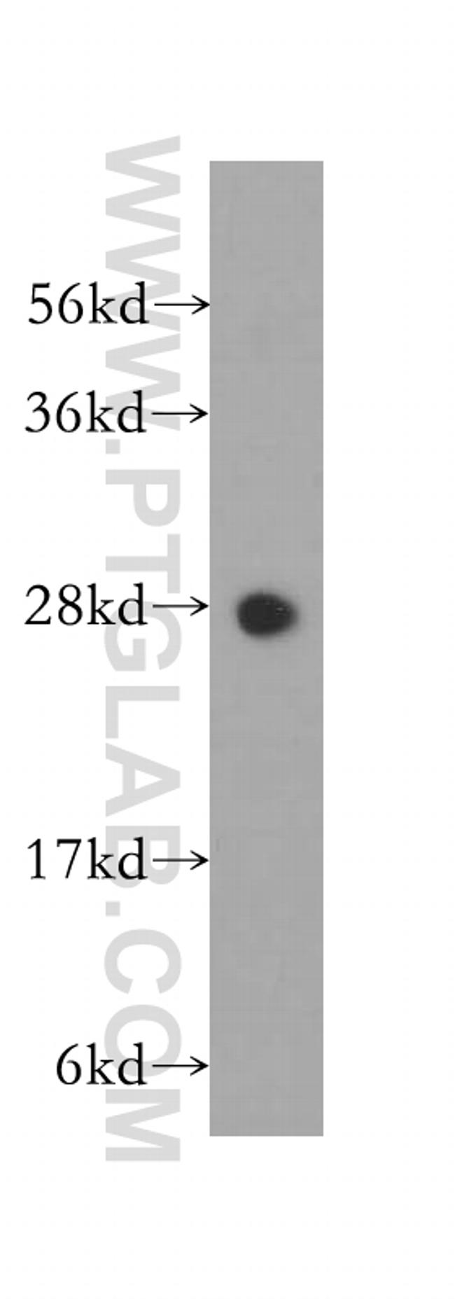 PSMA3 Antibody in Western Blot (WB)