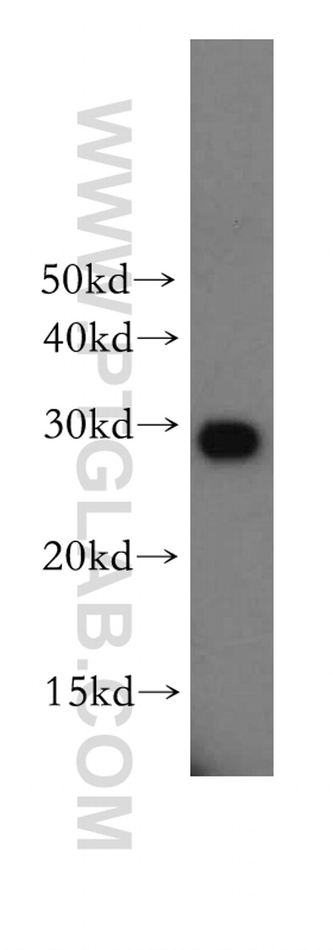 PSMA3 Antibody in Western Blot (WB)