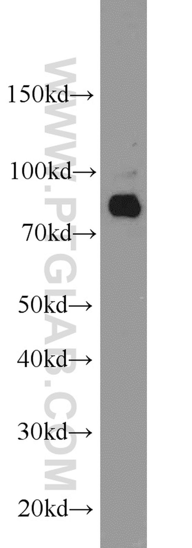 AGGF1 Antibody in Western Blot (WB)