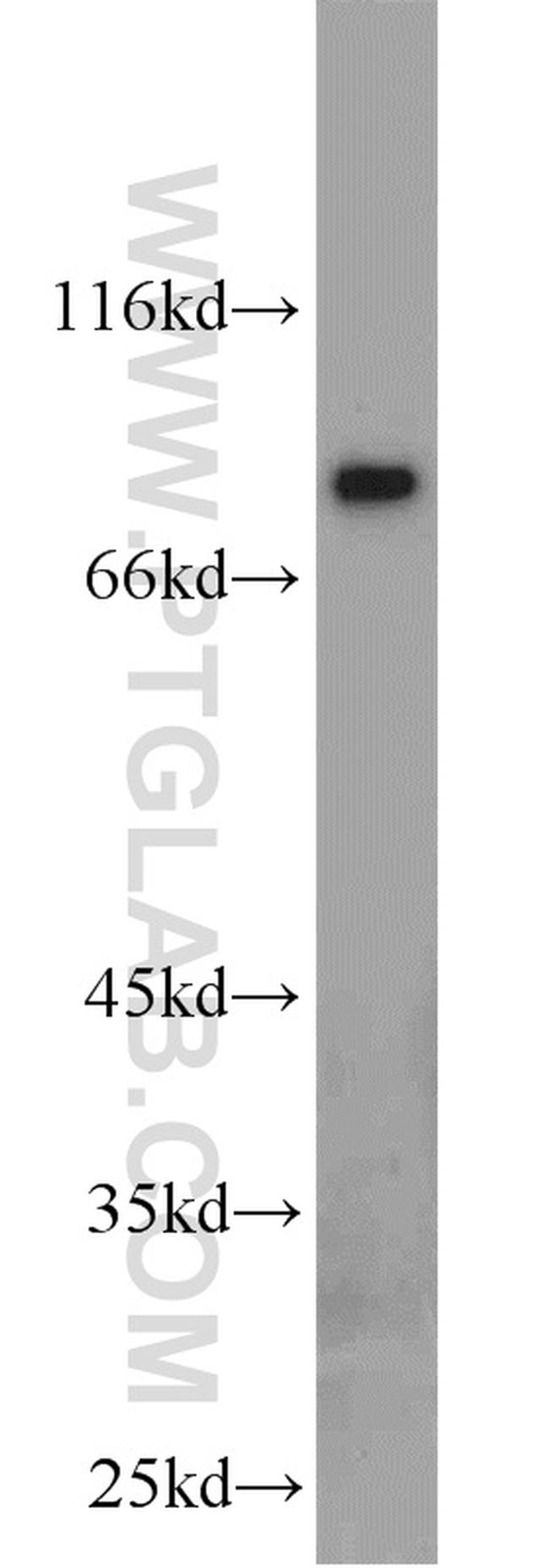 AGGF1 Antibody in Western Blot (WB)