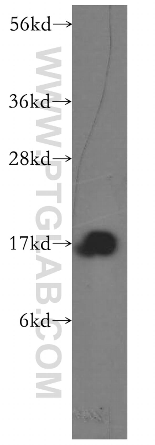 Prealbumin/transthyretin Antibody in Western Blot (WB)