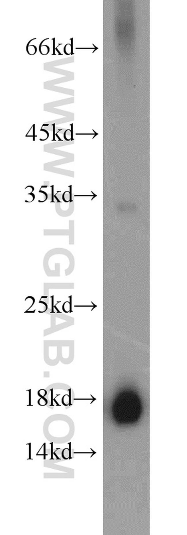 Prealbumin/transthyretin Antibody in Western Blot (WB)