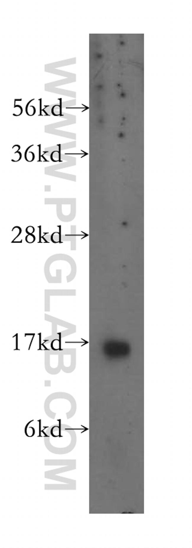 Prealbumin/transthyretin Antibody in Western Blot (WB)