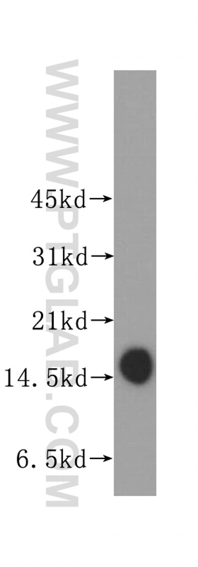 Prealbumin/transthyretin Antibody in Western Blot (WB)