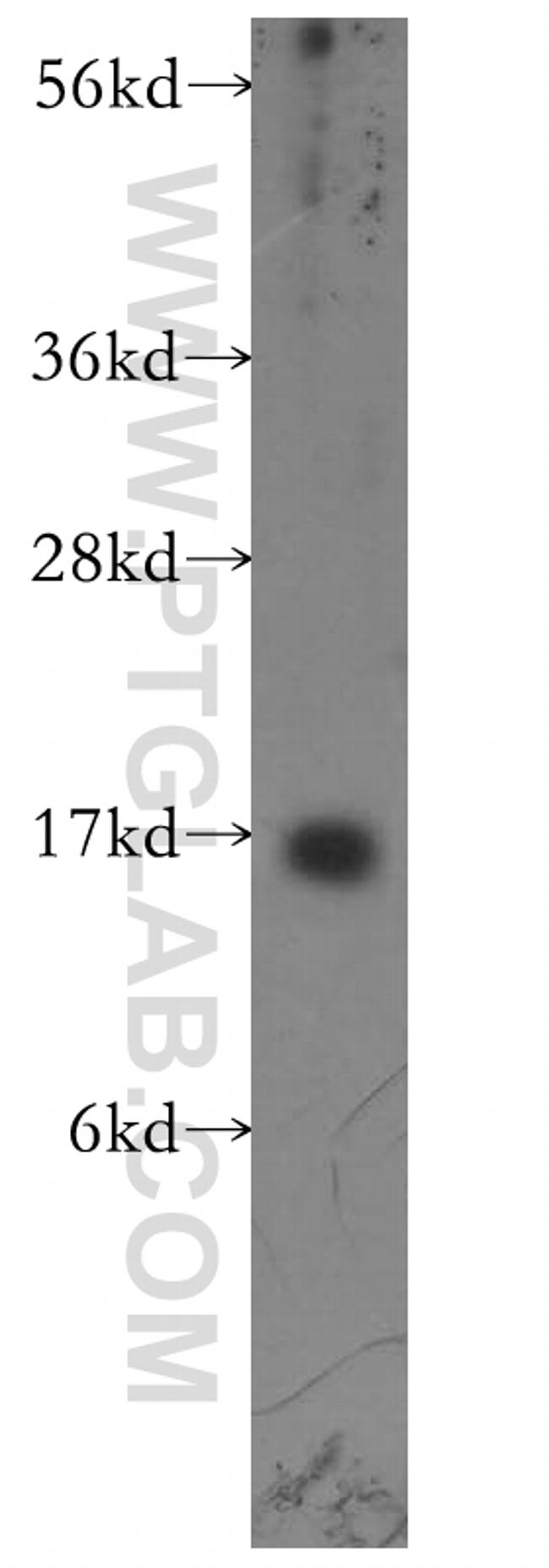 Prealbumin/transthyretin Antibody in Western Blot (WB)