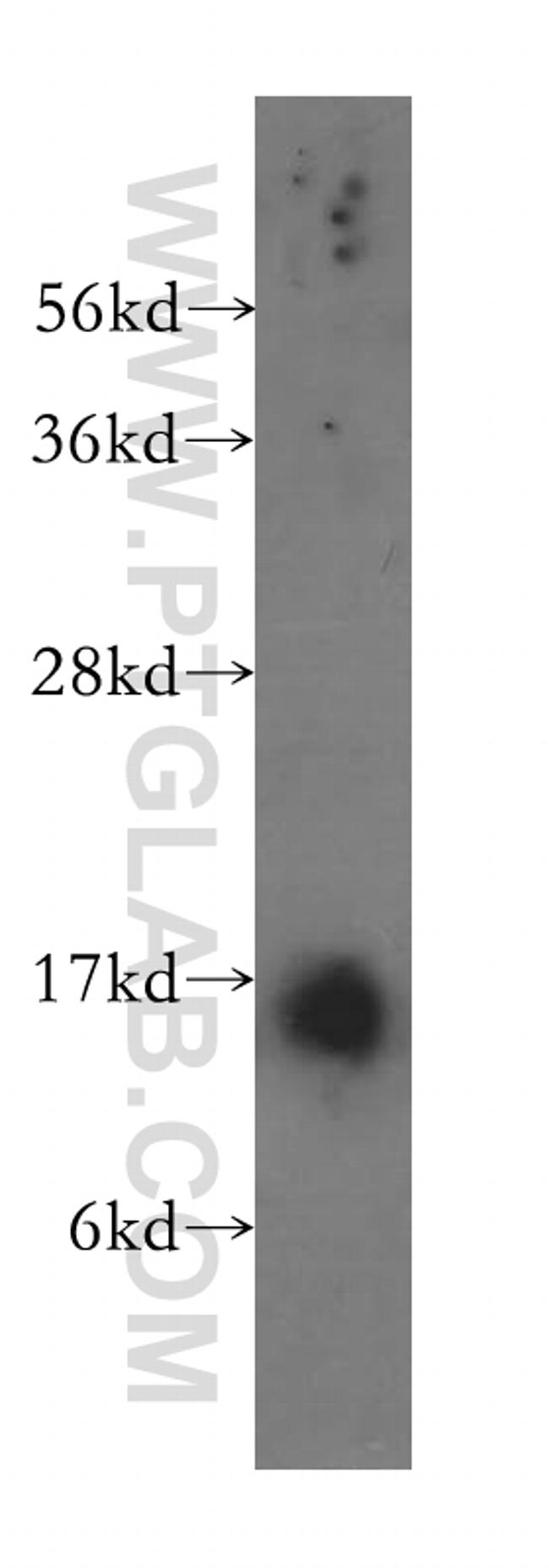 Prealbumin/transthyretin Antibody in Western Blot (WB)