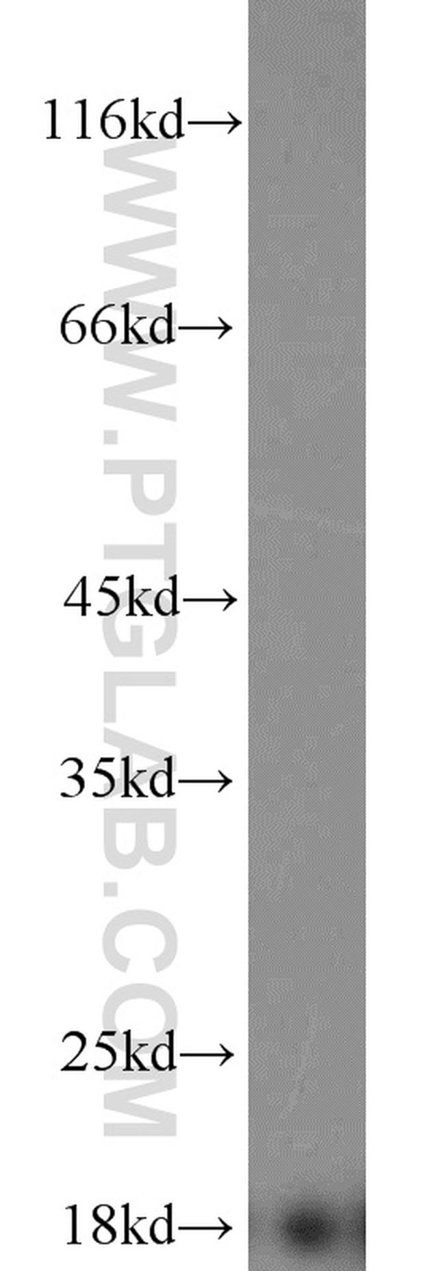 Prealbumin/transthyretin Antibody in Western Blot (WB)