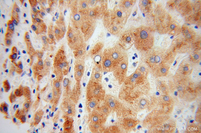 Prealbumin/transthyretin Antibody in Immunohistochemistry (Paraffin) (IHC (P))