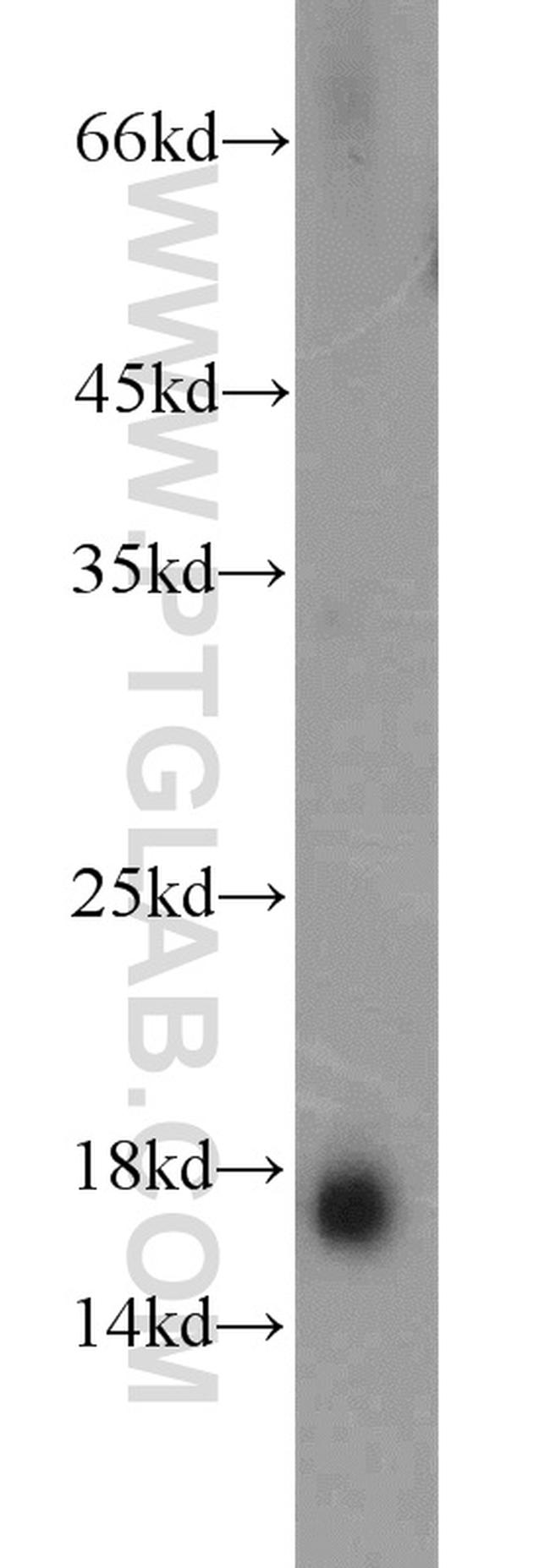 Prealbumin/transthyretin Antibody in Western Blot (WB)