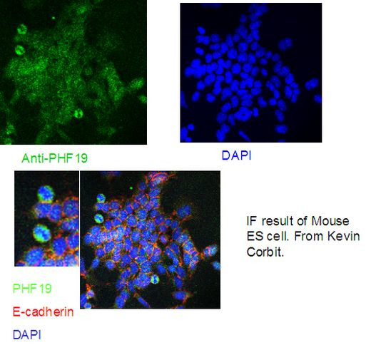 PHF19 Antibody in Immunocytochemistry (ICC/IF)