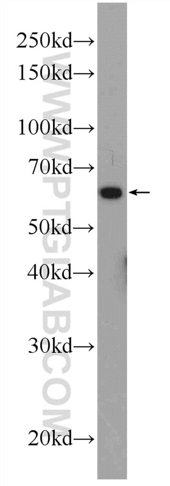 PHF19 Antibody in Western Blot (WB)
