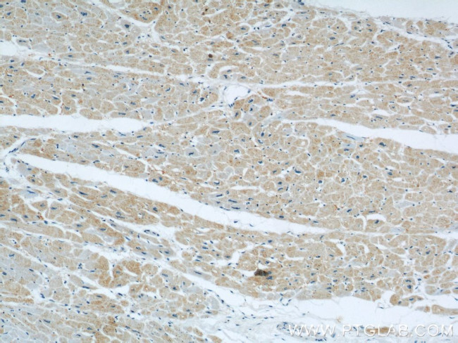 XIRP2 Antibody in Immunohistochemistry (Paraffin) (IHC (P))