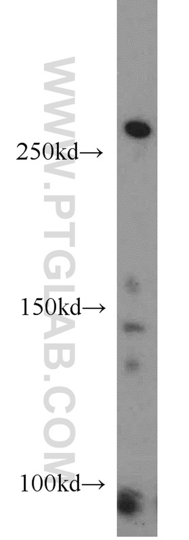 XIRP2 Antibody in Western Blot (WB)