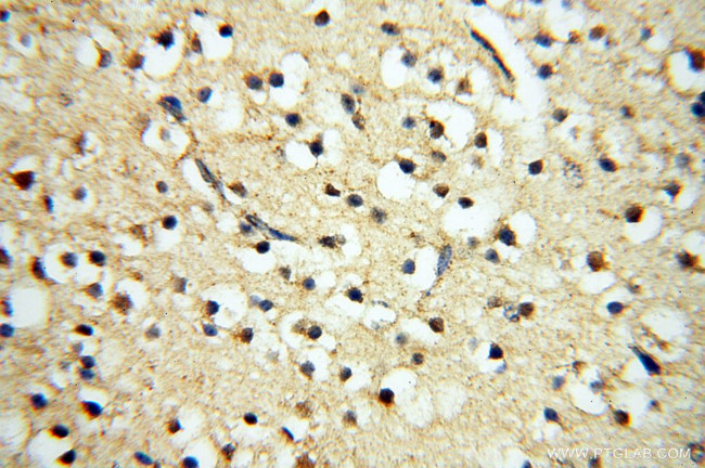 TERF1 Antibody in Immunohistochemistry (Paraffin) (IHC (P))