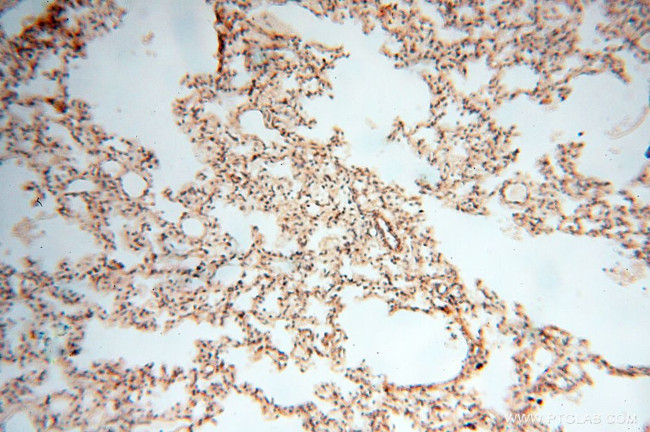 TERF1 Antibody in Immunohistochemistry (Paraffin) (IHC (P))