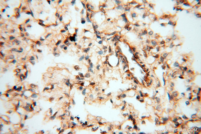 TERF1 Antibody in Immunohistochemistry (Paraffin) (IHC (P))