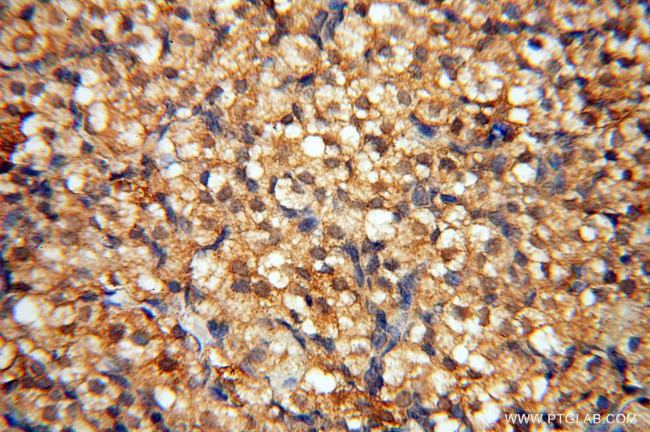 TERF1 Antibody in Immunohistochemistry (Paraffin) (IHC (P))