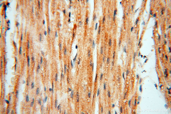 TERF1 Antibody in Immunohistochemistry (Paraffin) (IHC (P))