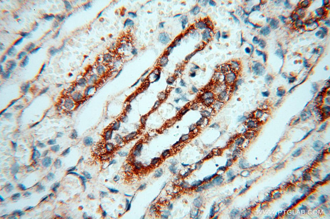 TERF1 Antibody in Immunohistochemistry (Paraffin) (IHC (P))