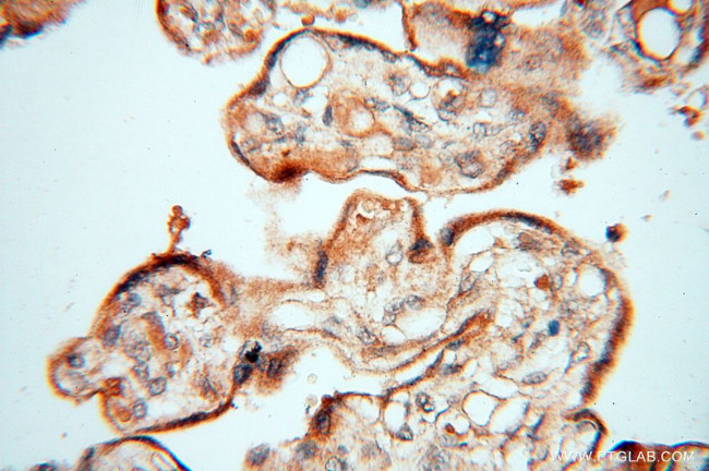 TERF1 Antibody in Immunohistochemistry (Paraffin) (IHC (P))