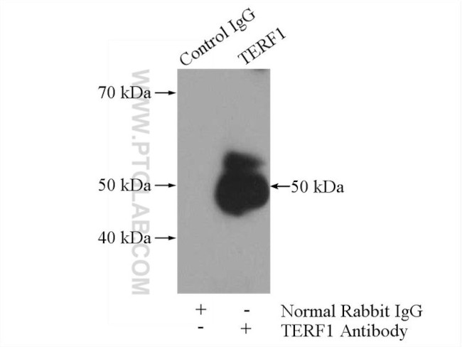 TERF1 Antibody in Immunoprecipitation (IP)