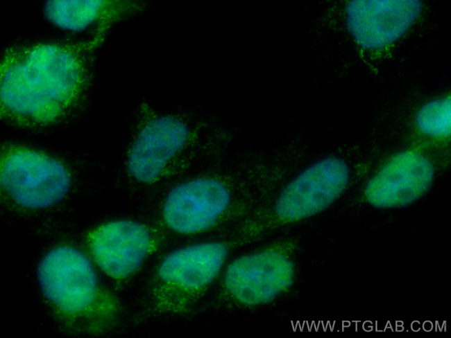 DGKE Antibody in Immunocytochemistry (ICC/IF)